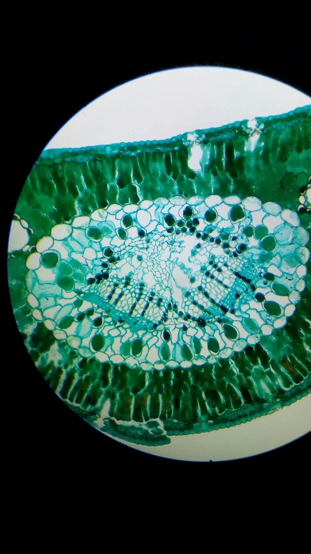 AmScope B120B Siedentopf Binocular Compound Microscope, 2000X | 40X-2000X Magnification Range Compound Biological Microscope Mechanical Stage Built-In LED Illumination Siedentopf customer photo 2
