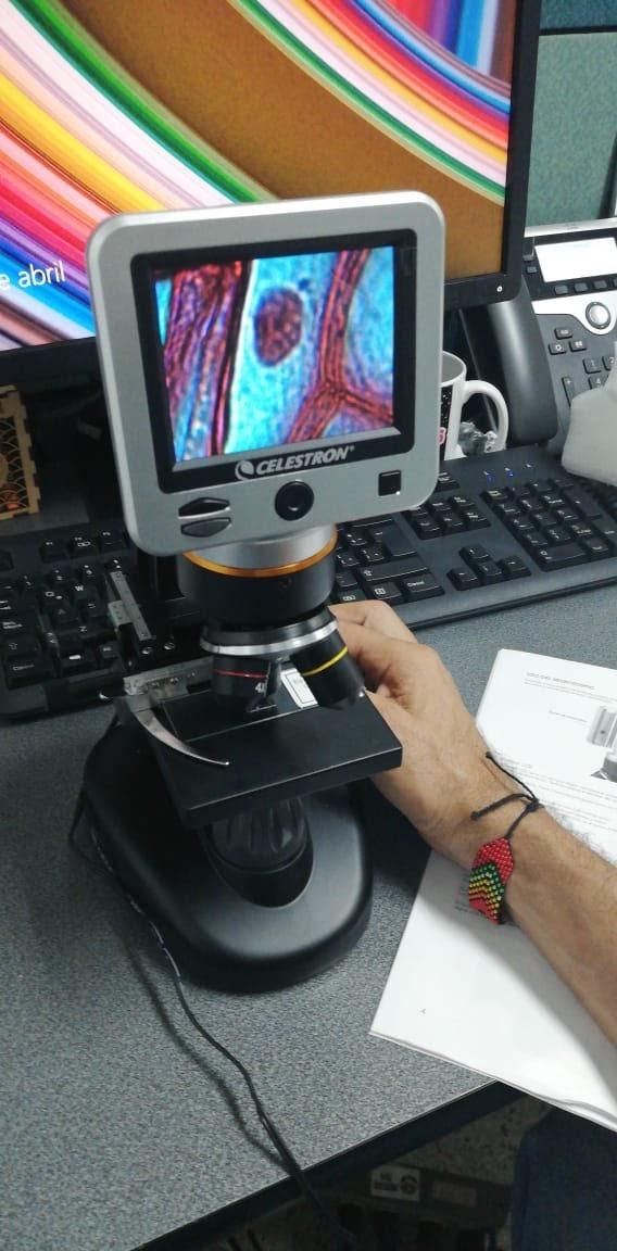 Celestron - TetraView LCD Digital Microscope - Biological Microscope with a Built-in 5MP Digital Camera - Adjustable Mechanical Stage - Carrying Case and 2GB Micro SD Card customer photo 1