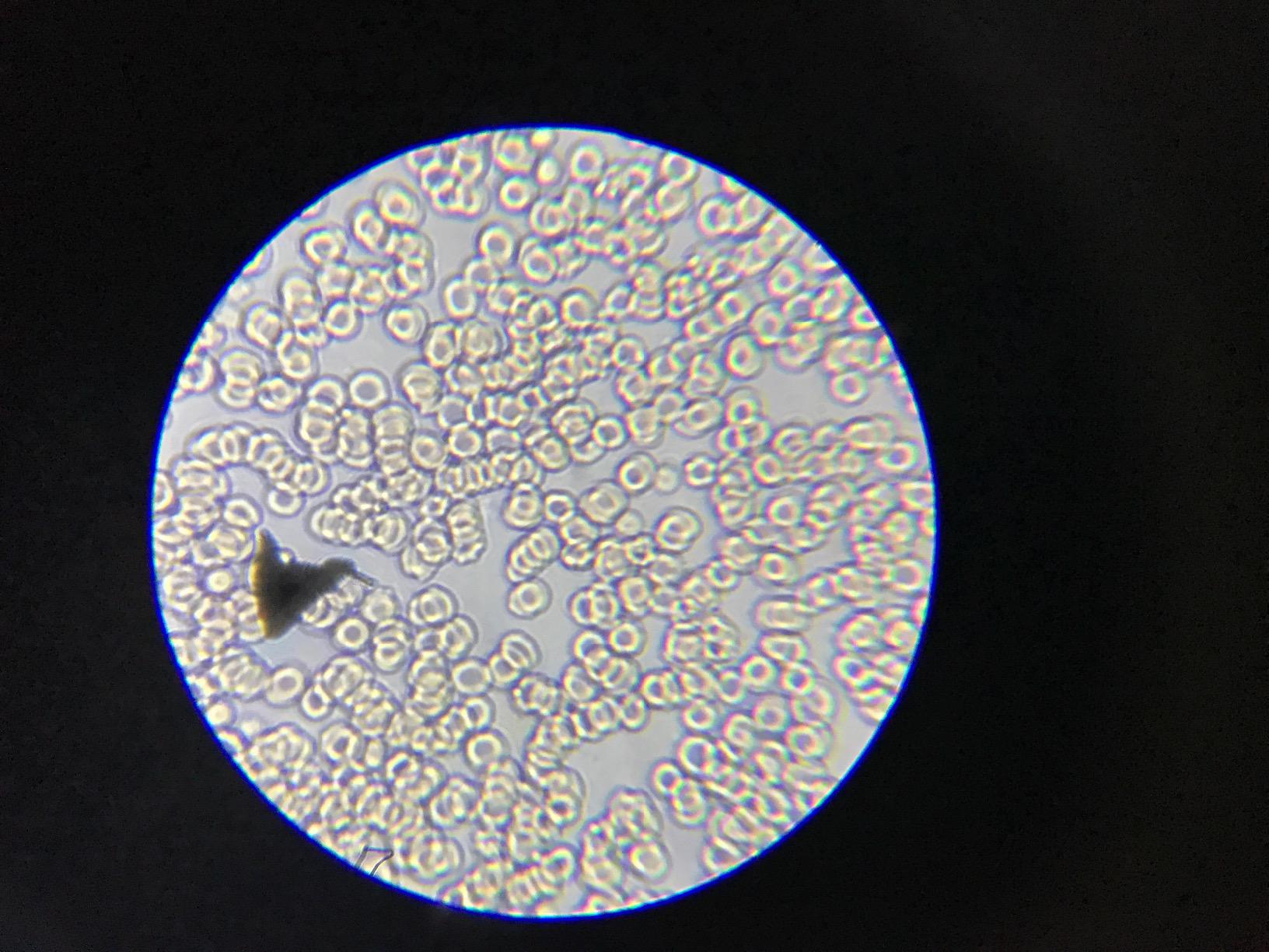 AmScope M162C-2L-PB10 1000X Dual Light Glass Lens Metal Frame Microscope, 40X-1000X Magnification Range customer photo 1