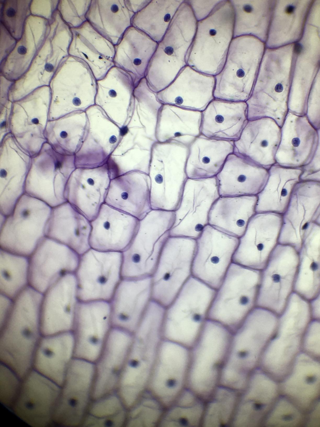 SWIFT SW350B 40X-2500X Magnification, Siedentopf Binocular Head, Research-Grade Compound Lab Microscope with Wide-Field 10X and 25X Eyepieces, Mechanical Stage, Abbe Condenser customer photo 1