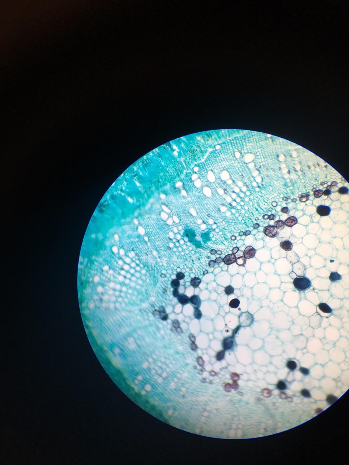 SWIFT SW350B 40X-2500X Magnification, Siedentopf Binocular Head, Research-Grade Compound Lab Microscope with Wide-Field 10X and 25X Eyepieces, Mechanical Stage, Abbe Condenser customer photo 2