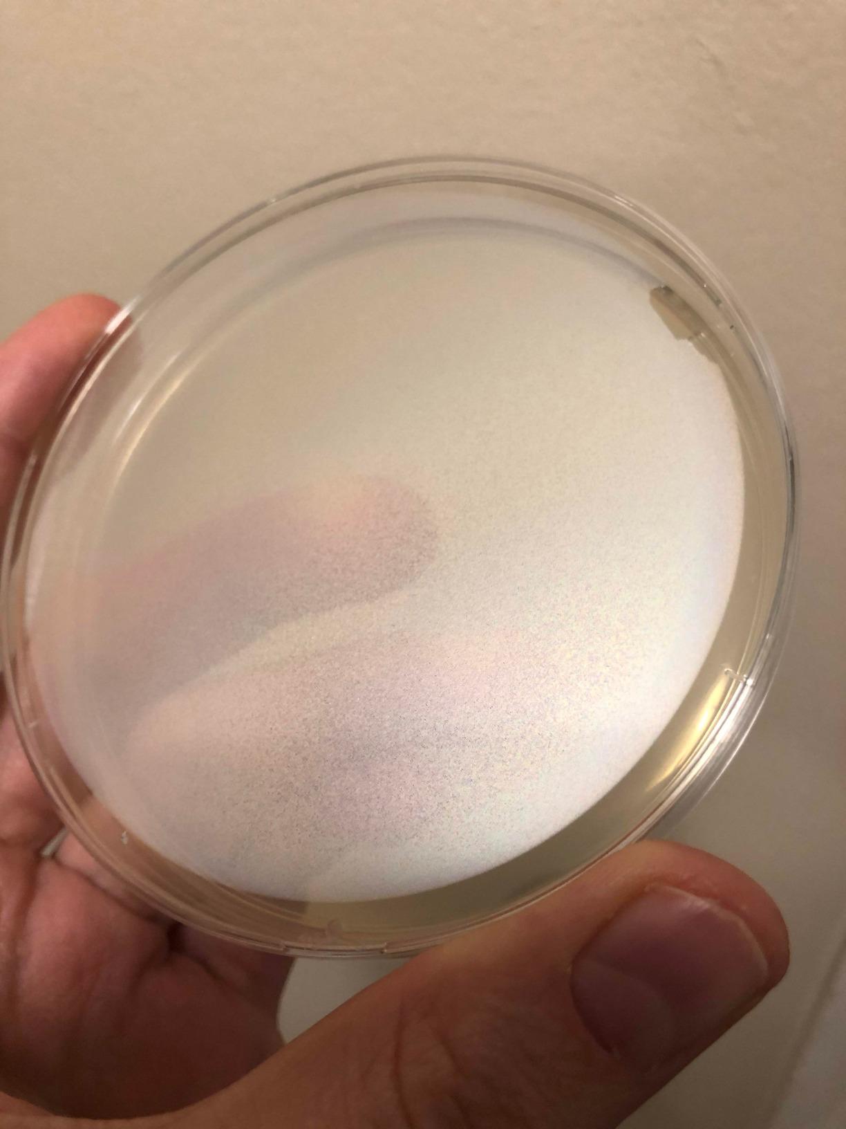 Evviva Sciences Microbiology Science Project Kit, Pre-Poured Agar Plates for Students, Agar Petri Dishes to Learn Microbiology, with Educational Experiment eBook customer photo 2