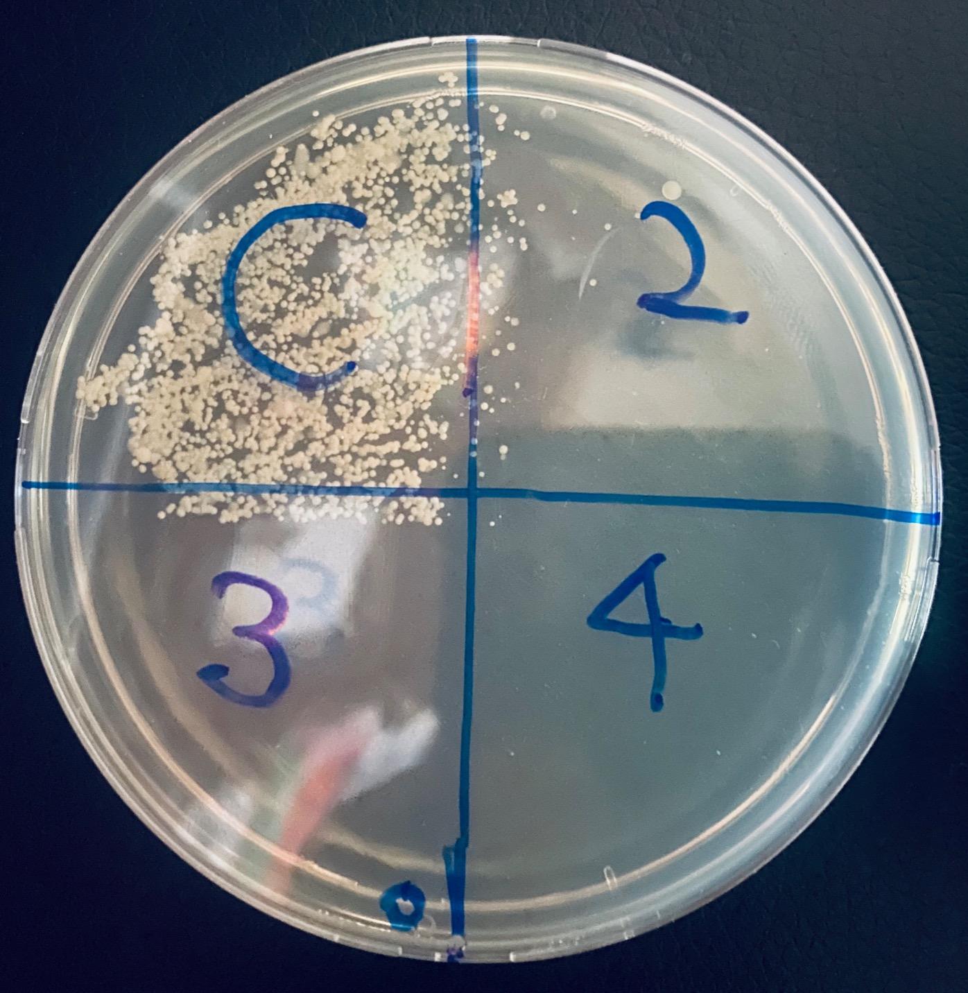 Bacteria Science Kit (IV): Top Science Fair Project Kit. Prepoured LB-Agar Plates And Cotton Swabs. Exclusive Free Science Fair Project E-Book Packed With Award Winning Experiments (IV) customer photo 1