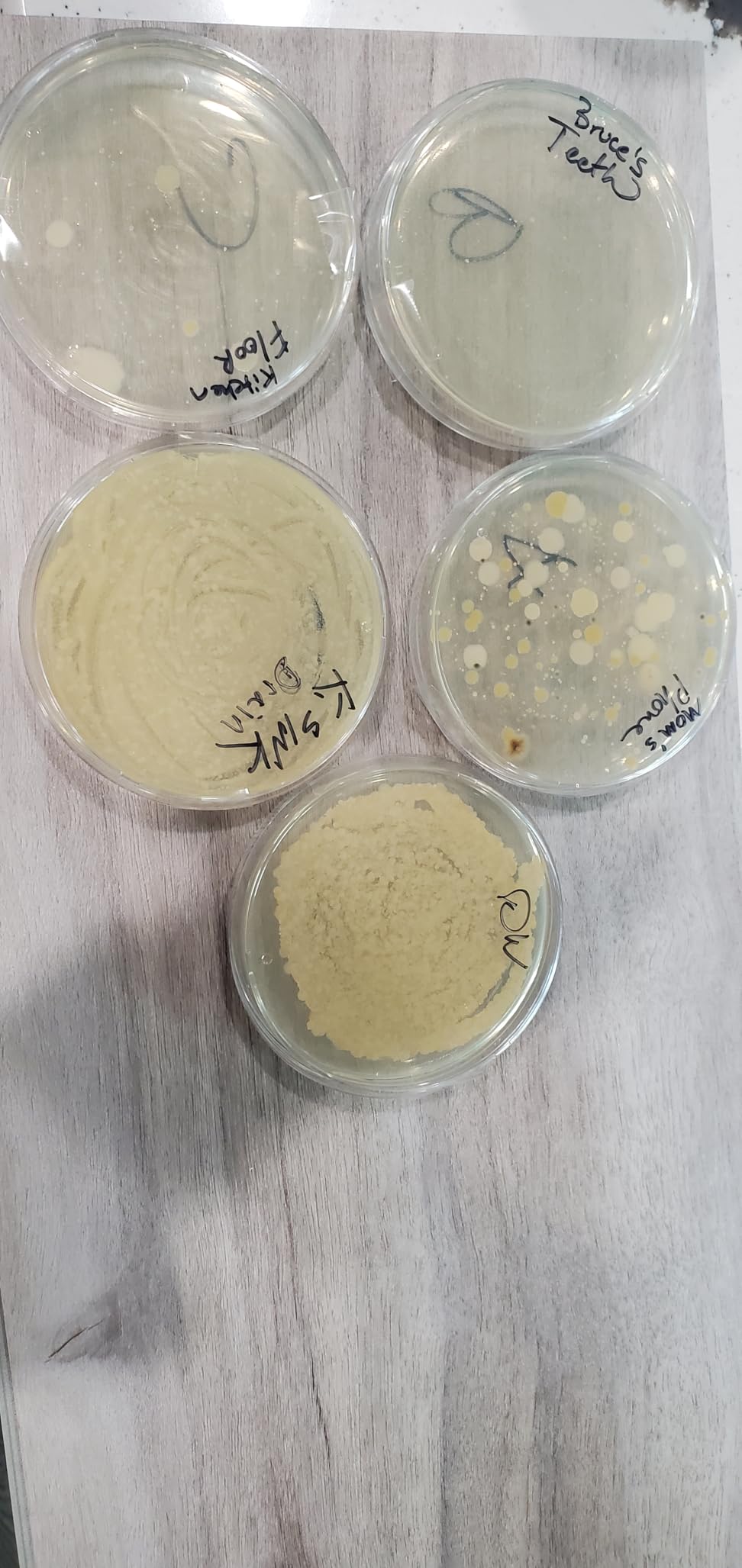 Bacteria Science Kit (IV): Top Science Fair Project Kit. Prepoured LB-Agar Plates And Cotton Swabs. Exclusive Free Science Fair Project E-Book Packed With Award Winning Experiments (IV) customer photo 2