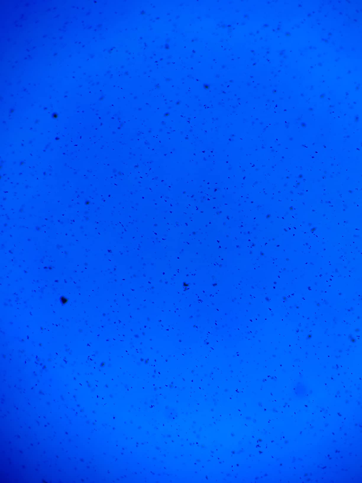 AmScope SK-5 ALDON Innovating Science Bacteria Stain Set - 5 Microscope | Five 30 ml Bacteria Stain Solutions for Microscope Slide Preparation with Safety Data Sheets customer photo 1