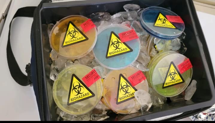 Bekith Petri Dishes with Lids, 50 Pack 90mm Dia x 15mm Deep Plastic Sterile Container, 50 Pack Plastic Transfer Pipettes(3ml) customer photo 1