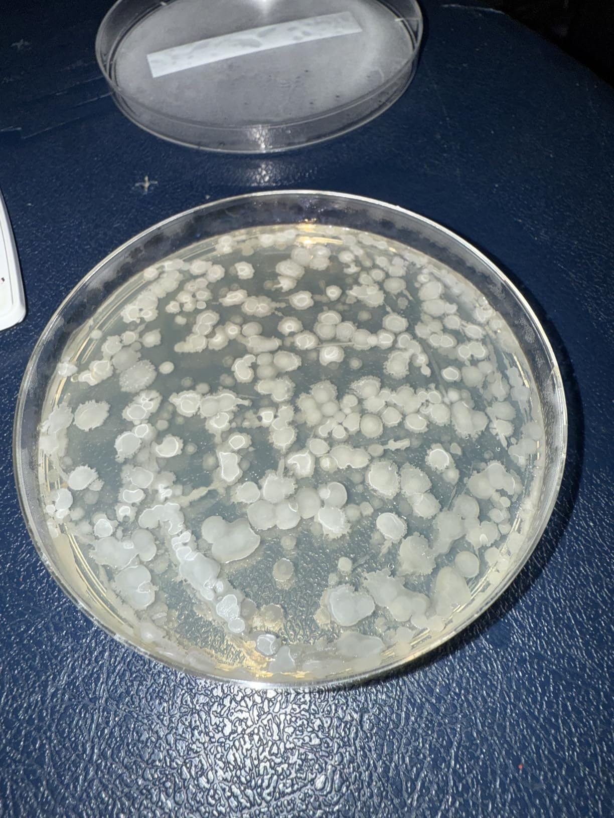 Bacteria Science Kit Petri Dishes with Agar and Swabs | Top Science Fair Project Bacteria Growing Kit | Prepoured LB-Agar Plates and Cotton Swabs | STEM for Kids Aged 6 7 8 9 10 Girls Boys Gifts customer photo 2