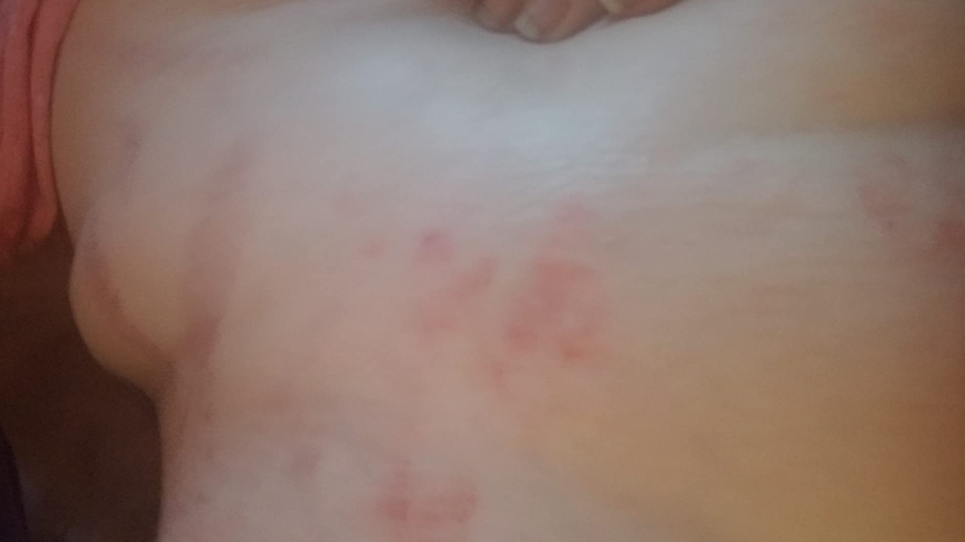 Manscape Body Hair Trimmer for Men, Waterproof Nick-Free Pubic Hair Trimmer customer photo 2