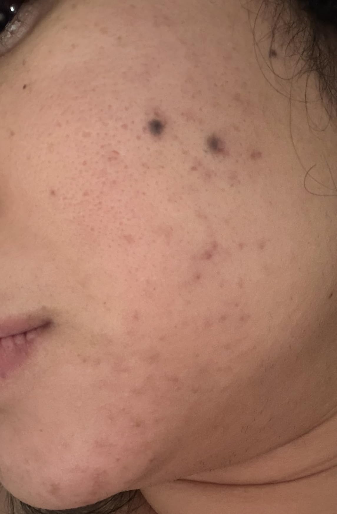 CeraVe Resurfacing Retinol Face Serum with Niacinamide, Pore Minimizer, 1oz customer photo 2